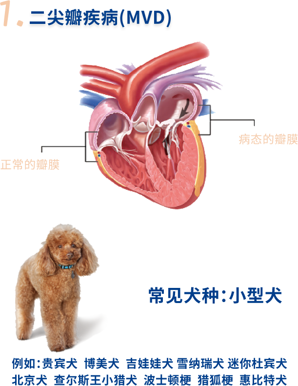 认识常见的心脏病 二尖瓣疾病